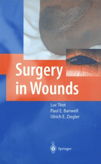 Ulrich E. Ziegler, Paul E. Banwell, Luc Teot - Surgery in Wounds, E-bok