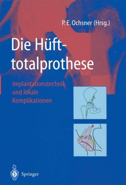 Peter E. Ochsner - Die Hüfttotalprothese, E-bok. Tillgänglighet: Lägg i varukorg