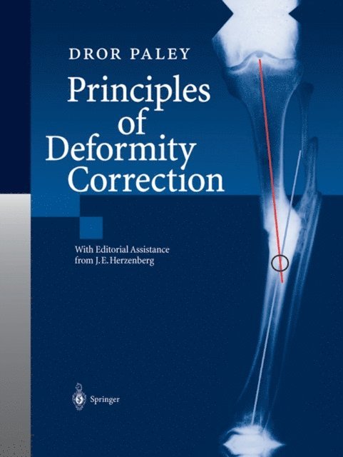 Dror Paley - Principles of Deformity Correction, E-bok