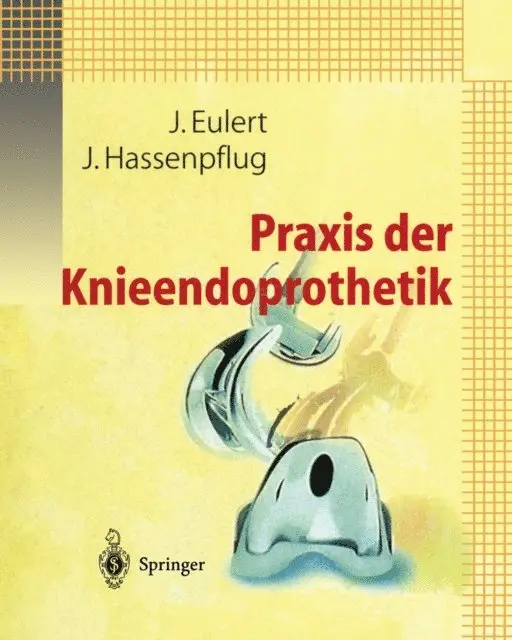 J. Hassenpflug, J. Eulert - Praxis der Knieendoprothetik, E-bok. Tillgänglighet: Lägg i varukorg