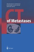 CT of Metastases
