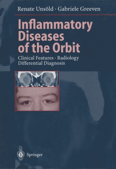 Gabriele Greeven, Renate Unsold - Inflammatory Diseases of the Orbit, E-bok