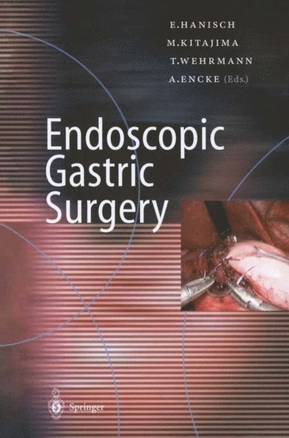 A. Encke, T. Wehrmann, M. Kitajima, E. Hanisch - Endoscopic Gastric Surgery, E-bok