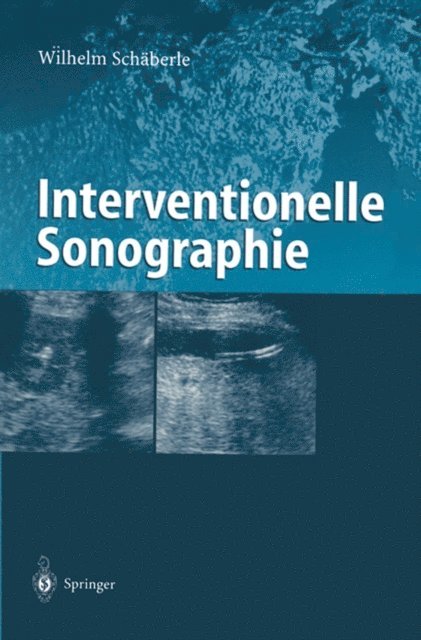 Wilhelm Schaberle - Interventionelle Sonographie, E-bok. Tillgänglighet: Lägg i varukorg