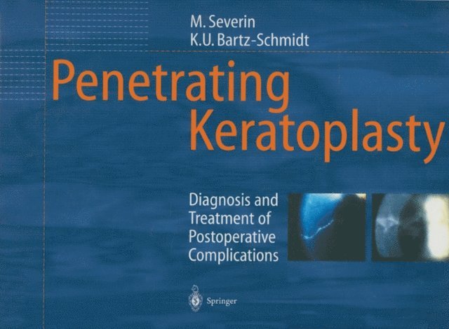 Karl-Ulrich Bartz-Schmidt, Maria Severin - Penetrating Keratoplasty, E-bok