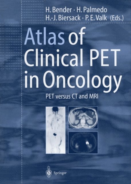 P.E. Valk, H.-J. Biersack, H. Palmedo, H. Bender - Atlas of Clinical PET in Oncology, E-bok