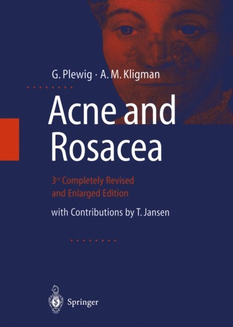 A.M. Kligman, G. Plewig - ACNE and ROSACEA, E-bok