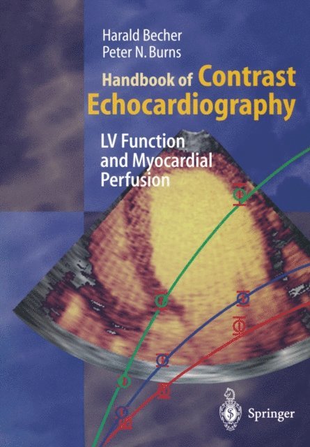 Peter N. Burns, Harald Becher - Handbook of Contrast Echocardiography, E-bok