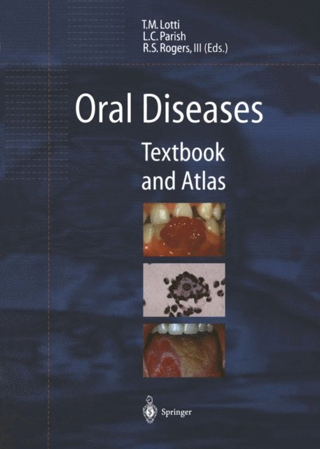 Roy S.III Rogers, Lawrence C. Parish, Torello M. Lotti - Oral Diseases, E-bok
