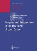 Progress and Perspective in the Treatment of Lung Cancer