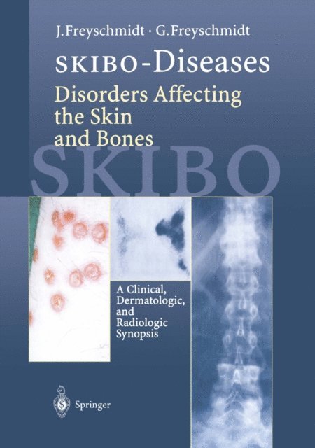 Gisela Freyschmidt, Jurgen Freyschmidt - SKIBO-Diseases Disorders Affecting the Skin and Bones, E-bok