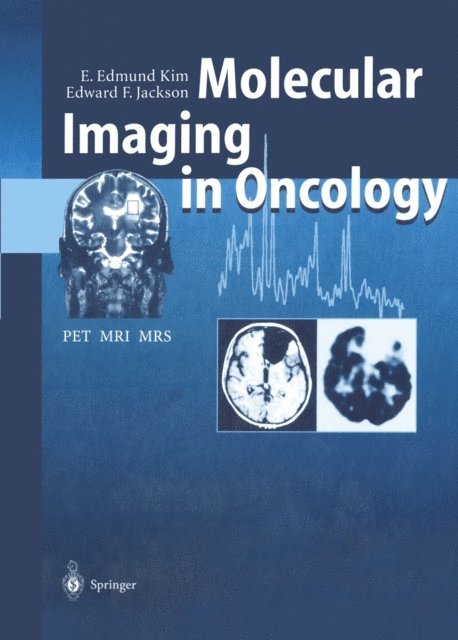 Edward F. Jackson, E. Edmund Kim - Molecular Imaging in Oncology, E-bok