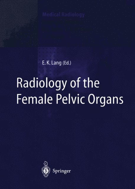 Erich K. Lang - Radiology of the Female Pelvic Organs, E-bok