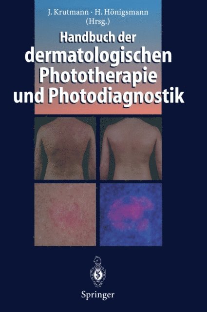 Herbert Honigsmann, Jean Krutmann - Handbuch der dermatologischen Phototherapie und Photodiagnostik, E-bok