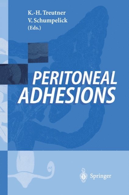 Volker Schumpelick, Karl-Heinz Treutner - Peritoneal Adhesions, E-bok