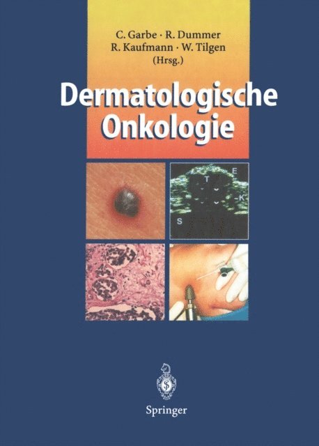 Wolfgang Tilgen, Roland Kaufmann, Reinhard Dummer, Claus Garbe - Dermatologische Onkologie, E-bok