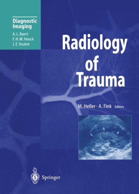 A. Fink, Martin Heller - Radiology of Trauma, E-bok