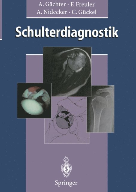 Claudius Guckel, Andreas Nidecker, Franz Freuler, Andre Gachter - Schulterdiagnostik, E-bok