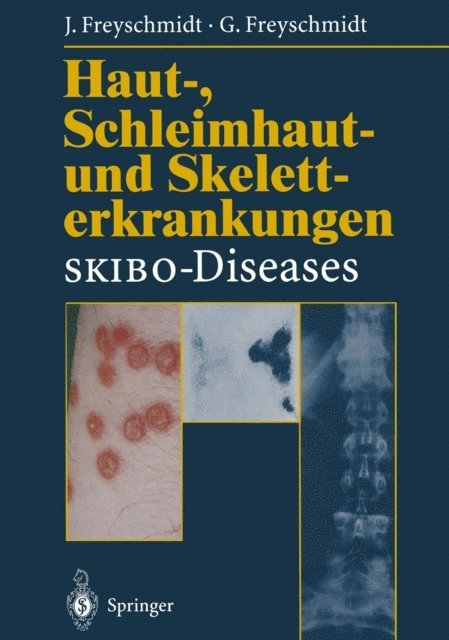 Gisela Freyschmidt, Jurgen Freyschmidt - Haut-, Schleimhaut- und Skeletterkrankungen SKIBO-Diseases, E-bok