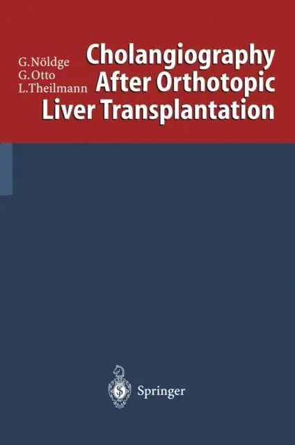 Lorenz Theilmann, Gerd Otto, Gerd Noldge - Cholangiography After Orthotopic Liver Transplantation, E-bok. Tillgänglighet: Lägg i varukorg