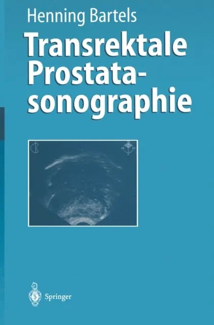 Henning Bartels - Transrektale Prostatasonographie, E-bok. Tillgänglighet: Lägg i varukorg