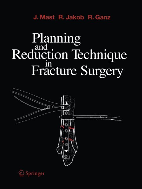 Reinhold Ganz, Roland Jakob, Jeffrey Mast - Planning and Reduction Technique in Fracture Surgery, E-bok