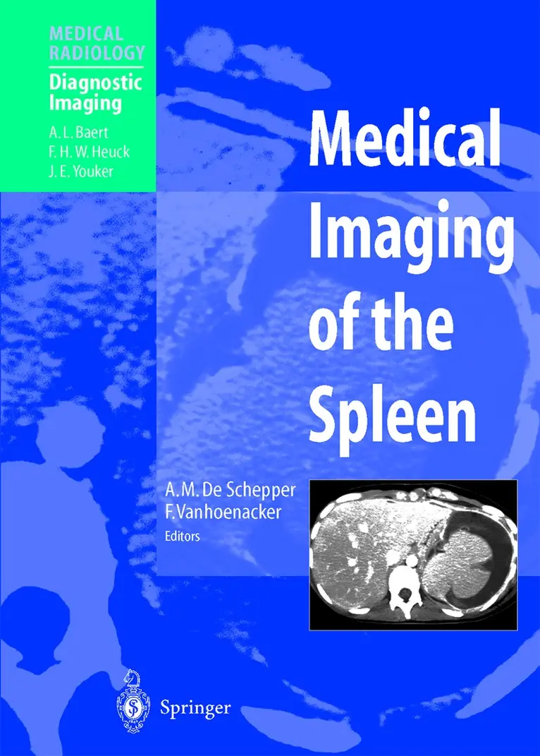 A.M. De Schepper, F. Vanhoenacker - Medical Imaging of the Spleen, Häftad. Tillgänglighet: Lägg i varukorg