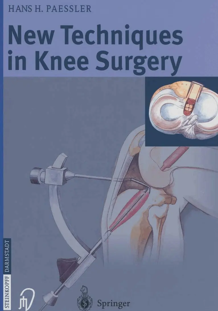 H.H. Paessler - New Techniques in Knee Surgery, Häftad. Tillgänglighet: Lägg i varukorg