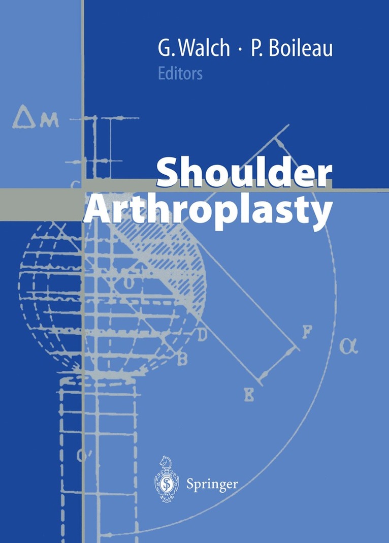 Gilles Walch, Pascal Boileau - Shoulder Arthroplasty, Häftad