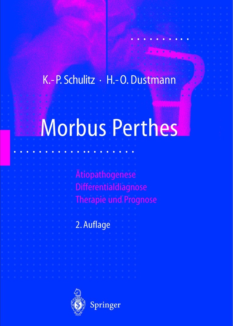 Morbus Perthes
