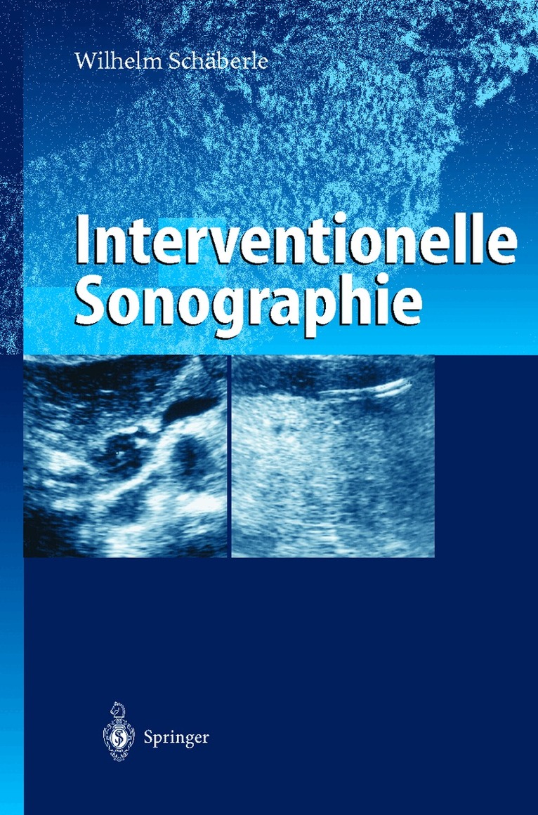 Wilhelm Schäberle - Interventionelle Sonographie, Häftad
