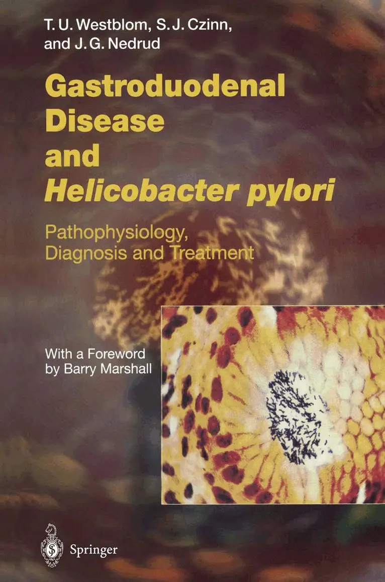 T. Ulf Westblom, Steven J. Czinn, John G. Nedrud - Gastroduodenal Disease and Helicobacter pylori, Häftad. Tillgänglighet: Lägg i varukorg