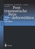 Posttraumatische Beindeformitten