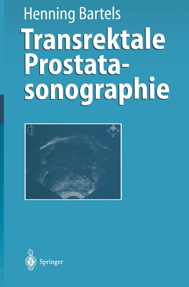 Henning Bartels - Transrektale Prostatasonographie, Häftad. Tillgänglighet: Lägg i varukorg