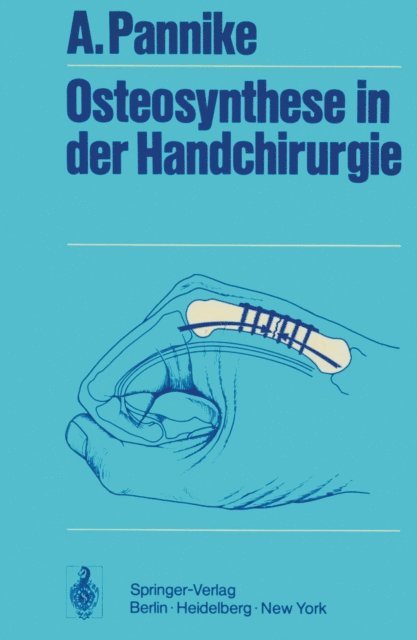 A. Pannike - Osteosynthese in der Handchirurgie, E-bok