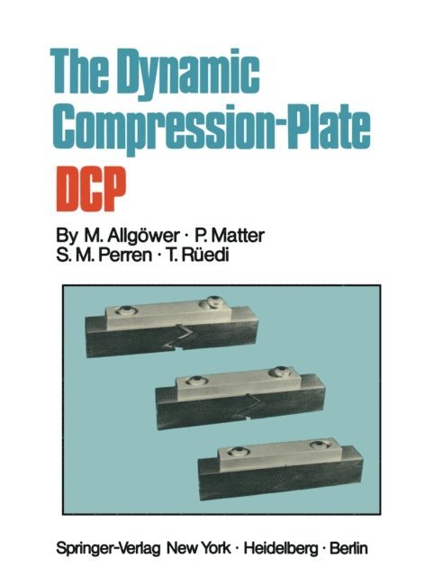 T. Ruedi, S.M. Perren, P. Matter, Martin Allgower - Dynamic Compression Plate DCP, E-bok