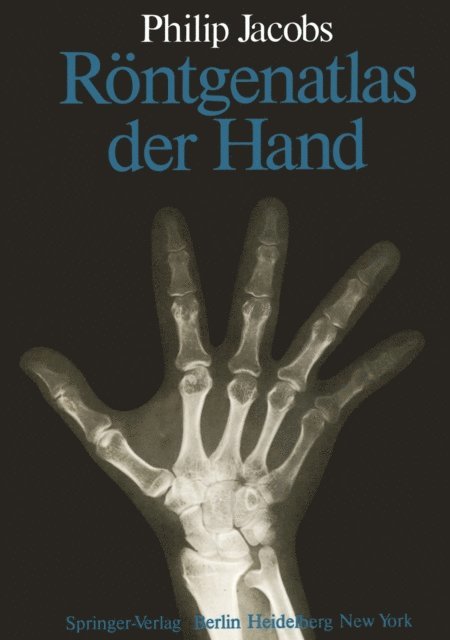 P. Jacobs - Röntgenatlas der Hand, E-bok