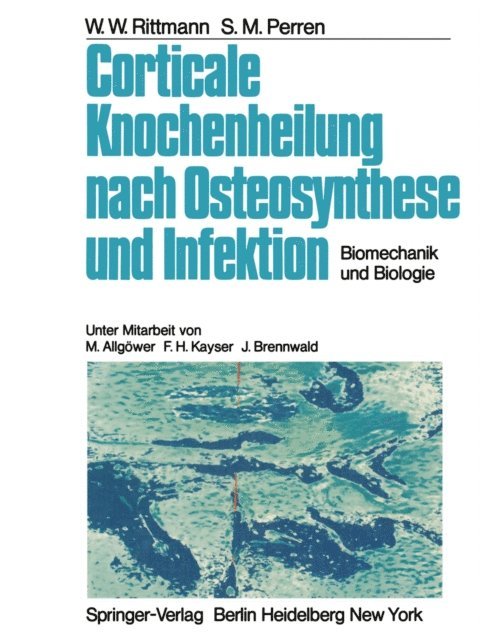 S.M. Perren, W.W. Rittmann - Corticale Knochenheilung nach Osteosynthese und Infektion, E-bok