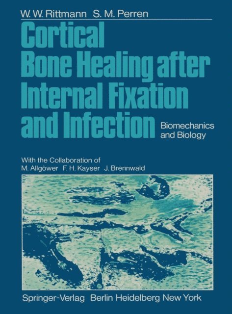 S.M. Perren, W.W. Rittmann - Cortical Bone Healing after Internal Fixation and Infection, E-bok