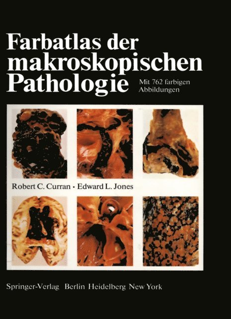 E. L. Jones, R. C. Curran - Farbatlas der makroskopischen Pathologie, E-bok