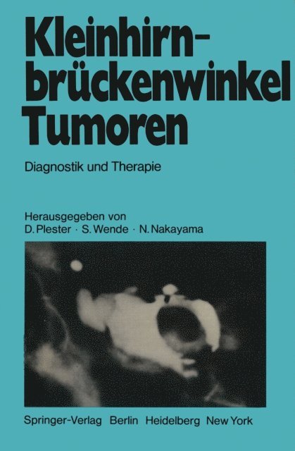 N. Nakayama, S. Wende, D. Plester - Kleinhirnbrückenwinkel-Tumoren, E-bok