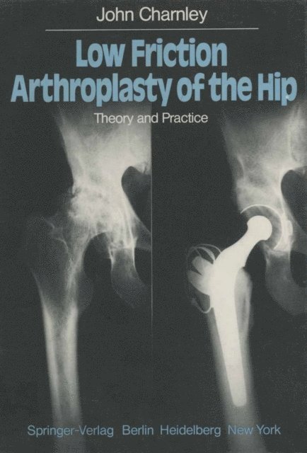 J. Charnley - Low Friction Arthroplasty of the Hip, E-bok