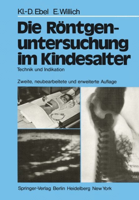Eberhard Willich, Klaus-D. Ebel - Die Röntgenuntersuchung im Kindesalter, E-bok
