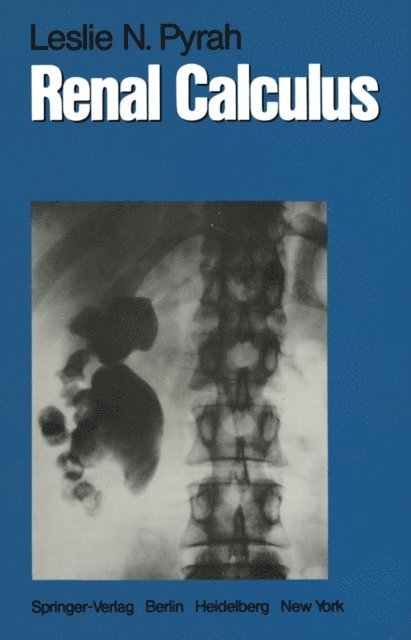 Leslie N. Pyrah - Renal Calculus, E-bok