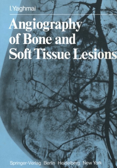 I. Yaghmai - Angiography of Bone and Soft Tissue Lesions, E-bok