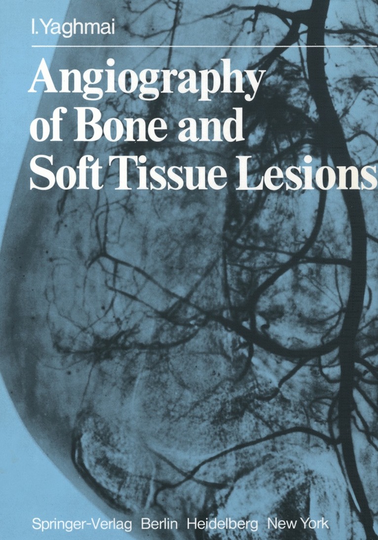I. Yaghmai - Angiography of Bone and Soft Tissue Lesions, Häftad