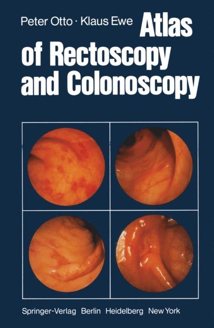 K. Ewe, P. Otto - Atlas of Rectoscopy and Coloscopy, E-bok