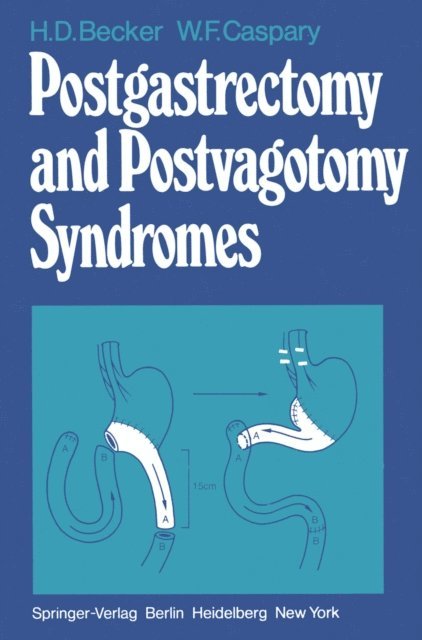 W. F. Caspary, H. D. Becker - Postgastrectomy and Postvagotomy Syndromes, E-bok