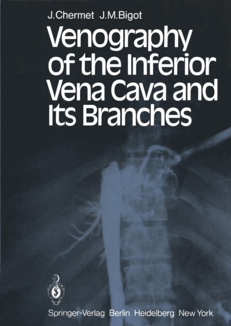 J. M. Bigot, J. Chermet - Venography of the Inferior Vena Cava and Its Branches, E-bok