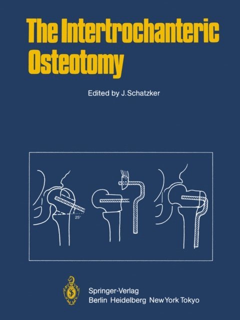J. Schatzker - Intertrochanteric Osteotomy, E-bok
